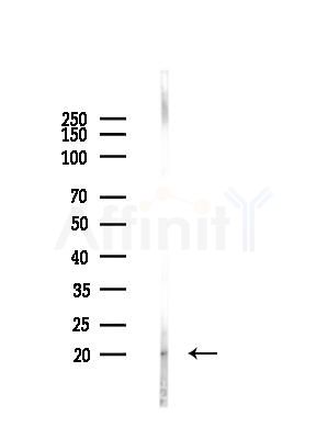 UBE2G1 Antibody - Western blot analysis of lysates from LoVo cells(heat-shock,45min treatment), using UBE2G1 Antibody at 1/1000 dilution.