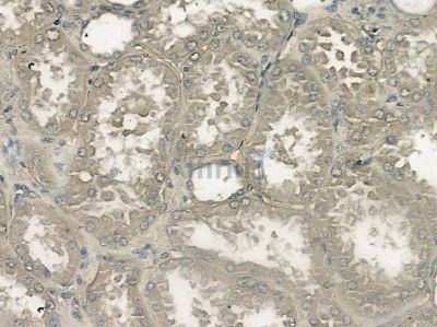 SEC22B Antibody - DF10010 at 1/100 staining mouse skin tissue by IHC-P.