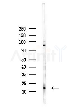 SEC22B Antibody - Western blot analysis of lysates from PC12 cells(heat-shock,45min treatment), using SEC22B Antibody at 1/1000 dilution.
