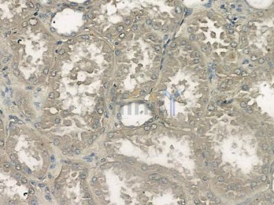 SEC22B Antibody - DF10010 at 1/100 staining human normal kidney tissue by IHC-P.