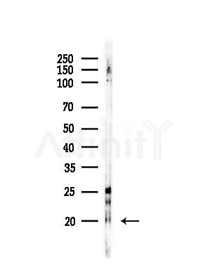 TMEM37 Antibody - Western blot analysis of lysates from EC304 cells, using TMEM37 Antibody at 1/1000 dilution.