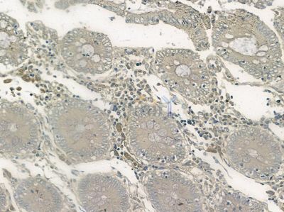 ZNHIT1 Antibody - DF10015 at 1/100 staining mouse liver tissue by IHC-P.