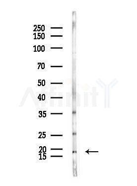 ZNHIT1 Antibody - Western blot analysis of lysates from LoVo cells(heat-shock,45min treatment), using ZNHIT1 Antibody at 1/1000 dilution.