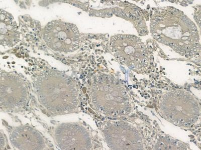 ZNHIT1 Antibody - DF10015 at 1/100 staining human normal colon tissue by IHC-P.