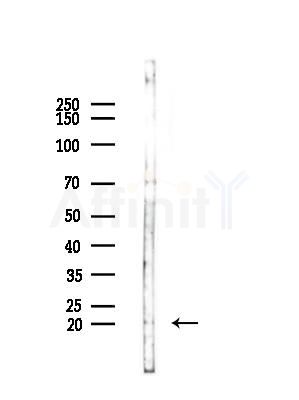CD164L2 Antibody - Western blot analysis of lysates from COLO205 cells(UV,30min treatment), using CD164L2 Antibody at 1/1000 dilution.