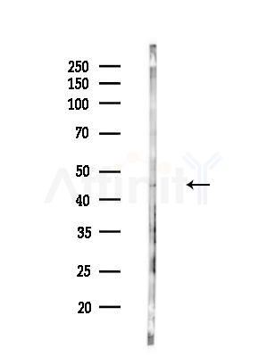 CCNI Antibody - Western blot analysis of lysates from EC304 cells(heat-shock treatment), using CCNI Antibody at 1/1000 dilution.