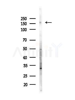 CDK13 Antibody - Western blot analysis of lysates from Hela cells(heat-shock,45min treatment), using CDK13 Antibody at 1/1000 dilution.
