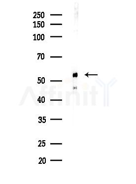 CD2L6 Antibody - Western blot analysis of lysates from MDA-MB-231 cells(heat-shock,45min treatment), using CD2L6 Antibody at 1/1000 dilution.