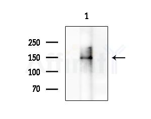 CD2L7 Antibody - Western blot analysis of extracts from HUVEC cells, using CD2L7 Antibody at 1/1000 dilution.