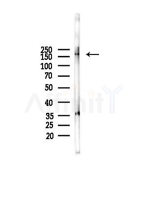 CD2L7 Antibody - Western blot analysis of lysates from HUVEC cells, using CD2L7 Antibody at 1/1000 dilution.