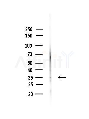 MAGEA3 Antibody - Western blot analysis of lysates from RAW264.