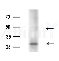 MAGEA8 Antibody - Western blot analysis of extracts from Mouse liver, using MAGEA8 Antibody at 1/1000 dilution.