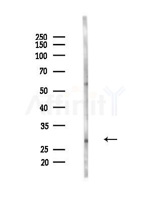 MAGEA8 Antibody - Western blot analysis of lysates from Mouse liver, using MAGEA8 Antibody at 1/1000 dilution.
