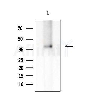 MAGEA12 Antibody - Western blot analysis of extracts from Rat brain, using MAGEA12 Antibody at 1/1000 dilution.