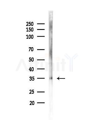 MAGEA12 Antibody - Western blot analysis of lysates from Rat brain, using MAGEA12 Antibody at 1/1000 dilution.