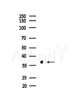 MAGBA Antibody - Western blot analysis of lysates from LoVo cells(heat-shock,45min treatment), using MAGBA Antibody at 1/1000 dilution.