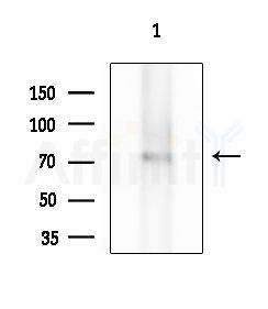 MAGD2 Antibody - Western blot analysis of extracts from Rat brain, using MAGD2 Antibody at 1/1000 dilution.
