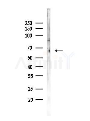MAGD2 Antibody - Western blot analysis of lysates from Rat brain, using MAGD2 Antibody at 1/1000 dilution.