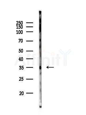 MAGG1 Antibody - Western blot analysis of lysates from HUVEC cells(heat-shock, 45min treatment), using MAGG1 Antibody at 1/1000 dilution.