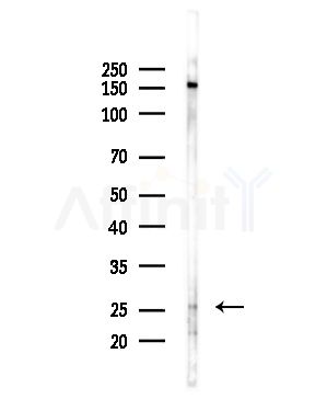 MAGH1 Antibody - Western blot analysis of lysates from Hela cells(LPS,4h treatment), using MAGH1 Antibody at 1/1000 dilution.