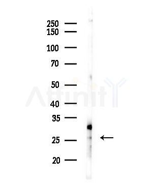MAGH1 Antibody - Western blot analysis of lysates from COLO205 cells(heat-shock,45min treatment), using MAGH1 Antibody at 1/1000 dilution.