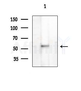 DMRTA1 Antibody - Western blot analysis of extracts from HUVEC cells, using DMRTA1 Antibody at 1/1000 dilution.