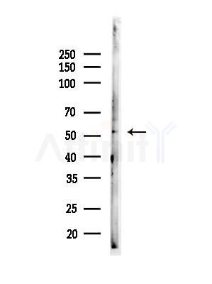DMRTA1 Antibody - Western blot analysis of lysates from HUVEC cells, using DMRTA1 Antibody at 1/1000 dilution.