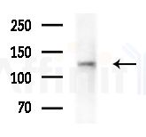 LARP2 Antibody - Western blot analysis of extracts from Rat liver, using LARP2 Antibody at 1/1000 dilution.