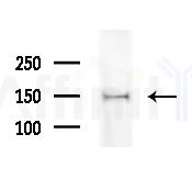 LARP2 Antibody - Western blot analysis of extracts from EC304 cells(heat-shock treatment), using LARP2 Antibody at 1/1000 dilution.