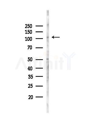 LARP2 Antibody - Western blot analysis of lysates from EC304 cells(heat-shock,45min treatment), using LARP2 Antibody at 1/1000 dilution.