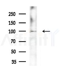 ZNF839 Antibody - Western blot analysis of extracts from various samples, using ZNF839 Antibody at 1/1000 dilution.