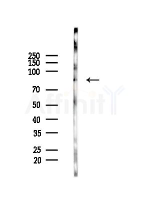 ZNF839 Antibody - Western blot analysis of lysates from HepG2 cells(LPS,4h treatment), using ZNF839 Antibody at 1/1000 dilution.