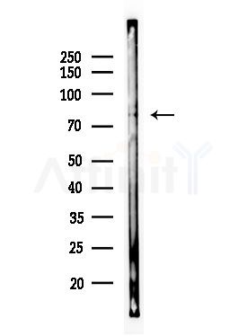 ZNF441 Antibody - Western blot analysis of lysates from Hela cells(heat-shock,45min treatment), using ZNF441 Antibody at 1/1000 dilution.