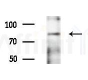 NEB2 Antibody - Western blot analysis of extracts from EC304 cells(heat-shock treatment), using NEB2 Antibody at 1/1000 dilution.