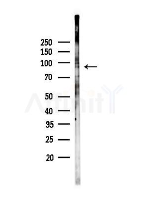 NEB2 Antibody - Western blot analysis of lysates from EC304 cells(heat-shock,45min treatment), using NEB2 Antibody at 1/1000 dilution.