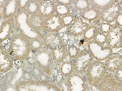 MYCBP Antibody - DF10076 at 1/100 staining mouse skin tissue by IHC-P.