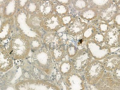 MYCBP Antibody - DF10076 at 1/100 staining human normal kidney tissue by IHC-P.