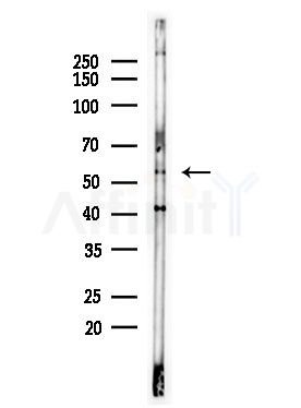 ZNF577 Antibody - Western blot analysis of lysates from LoVo cells(heat-shock,45min treatment), using ZNF577 Antibody at 1/1000 dilution.