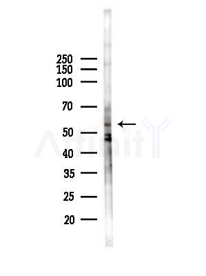 POLM Antibody - Western blot analysis of lysates from HepG2 cells(starvation,24h treatment), using POLM Antibody at 1/1000 dilution.