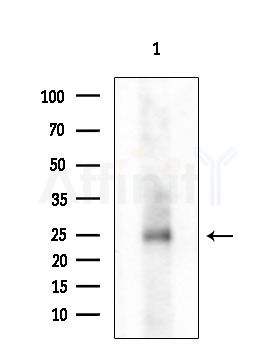 NOLA1 Antibody - Western blot analysis of extracts from COLO205 cells, using NOLA1 Antibody at 1/1000 dilution.