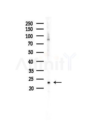 NOLA1 Antibody - Western blot analysis of lysates from COLO205 cells, using NOLA1 Antibody at 1/1000 dilution.