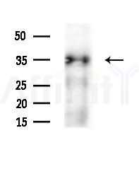 RTDR1 Antibody - Western blot analysis of extracts from various samples, using RTDR1 Antibody at 1/1000 dilution.