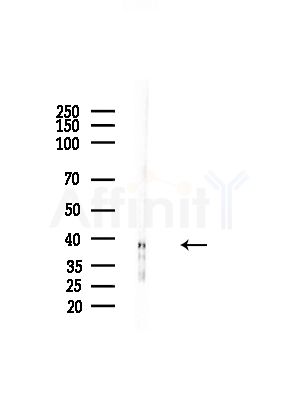 RTDR1 Antibody - Western blot analysis of lysates from HepG2 cells(LPS,4h treatment), using RTDR1 Antibody at 1/1000 dilution.