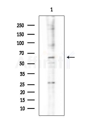 CDYL1 Antibody - Western blot analysis of extracts from Hela cells(LPS 4h treatment), using CDYL1 Antibody at 1/1000 dilution.