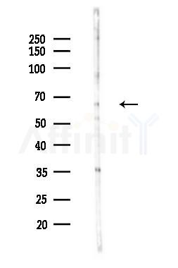 CDYL1 Antibody - Western blot analysis of lysates from Hela cells(LPS 4h treatment), using CDYL1 Antibody at 1/1000 dilution.