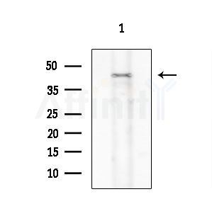 CCBE1 Antibody - Western blot analysis of extracts from Rat lung, using CCBE1 Antibody at 1/1000 dilution.