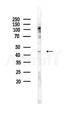 CCBE1 Antibody - Western blot analysis of lysates from Rat lung, using CCBE1 Antibody at 1/1000 dilution.