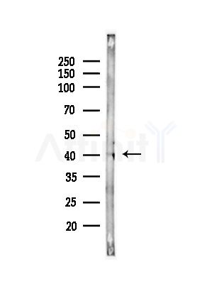 IL20L2 Antibody - Western blot analysis of lysates from COLO205 cells(UV,30min treatment), using IL20L2 Antibody at 1/1000 dilution.