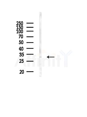 IL22RA2 Antibody - Western blot analysis of lysates from Rat lung, using IL22RA2 Antibody at 1/1000 dilution.