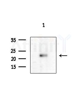 IL1F9 Antibody - Western blot analysis of extracts from COLO205 cells, using IL1F9 Antibody at 1/1000 dilution.